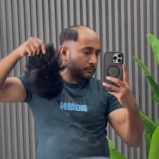 Wigcenter00 hair patch Jalandhar